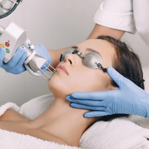 Láser Co2 Fraccionado